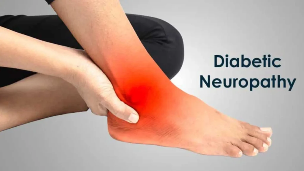 Diabetic Neuropathy