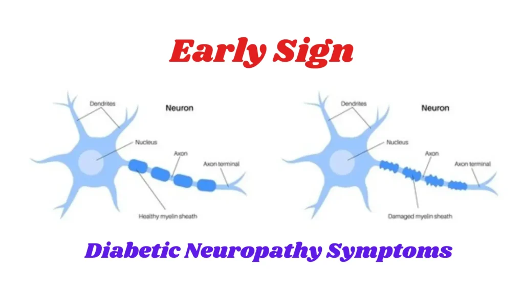 Diabetes Neuropathy Symptoms