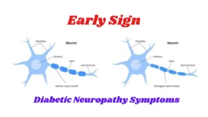 Diabetic Neuropathy Symptoms