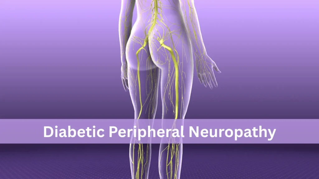 Diabetic Peripheral Neuropathy