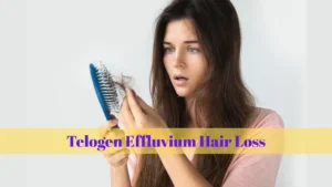 telogen effluvium hair loss