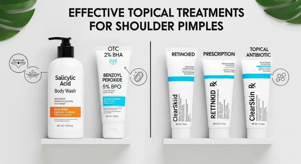 Effective Topical Treatments for Pimples On Shoulders