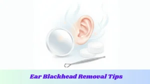 Ear blackhead removal