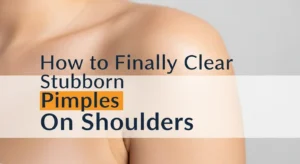 pimples on shoulders