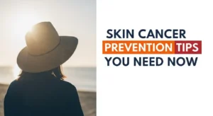 skin cancer prevention tips